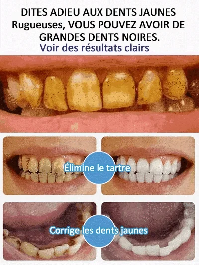 🔥Dernier jour 49% de remise🔥 Dentifrice Super Probiotic-6 aux 6 probiotiques pour équilibrer le microbiote buccal
