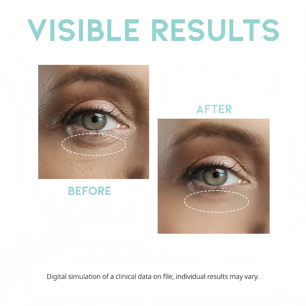 OOTD Wrinkle Lift Eye Serum 30g