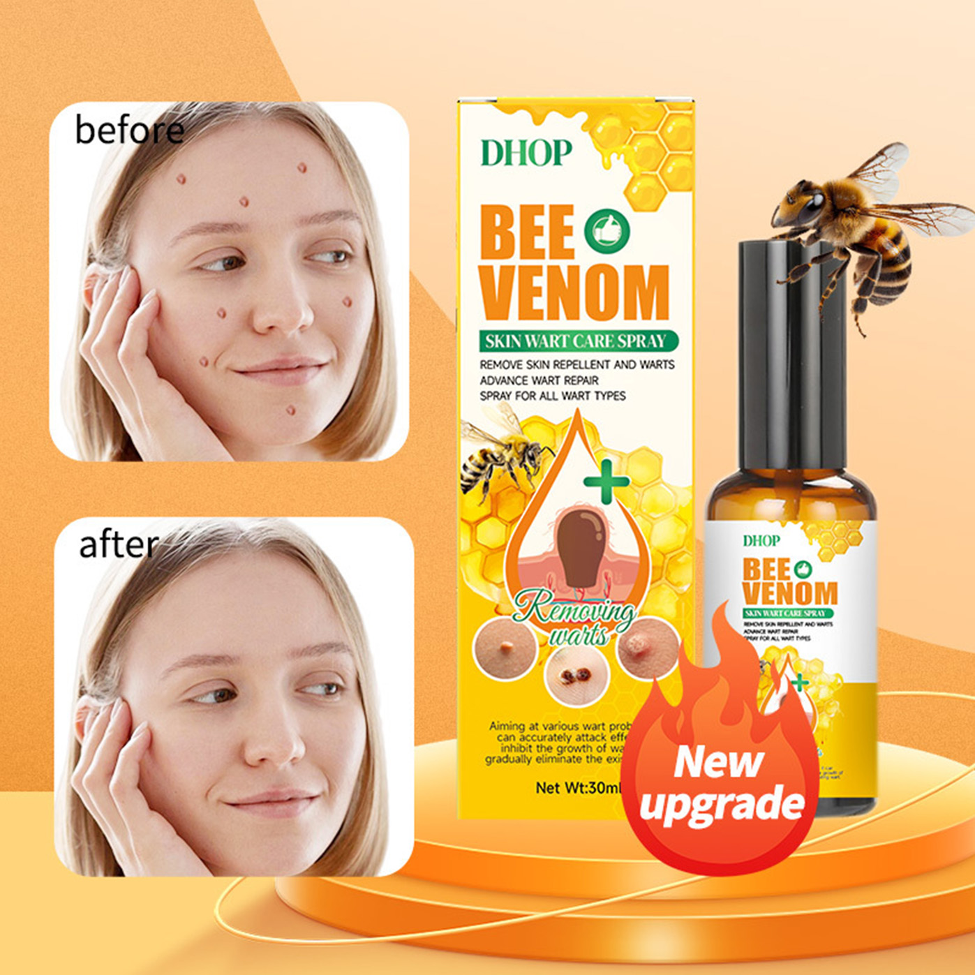 Bee Venom Skin Wart Care Spray