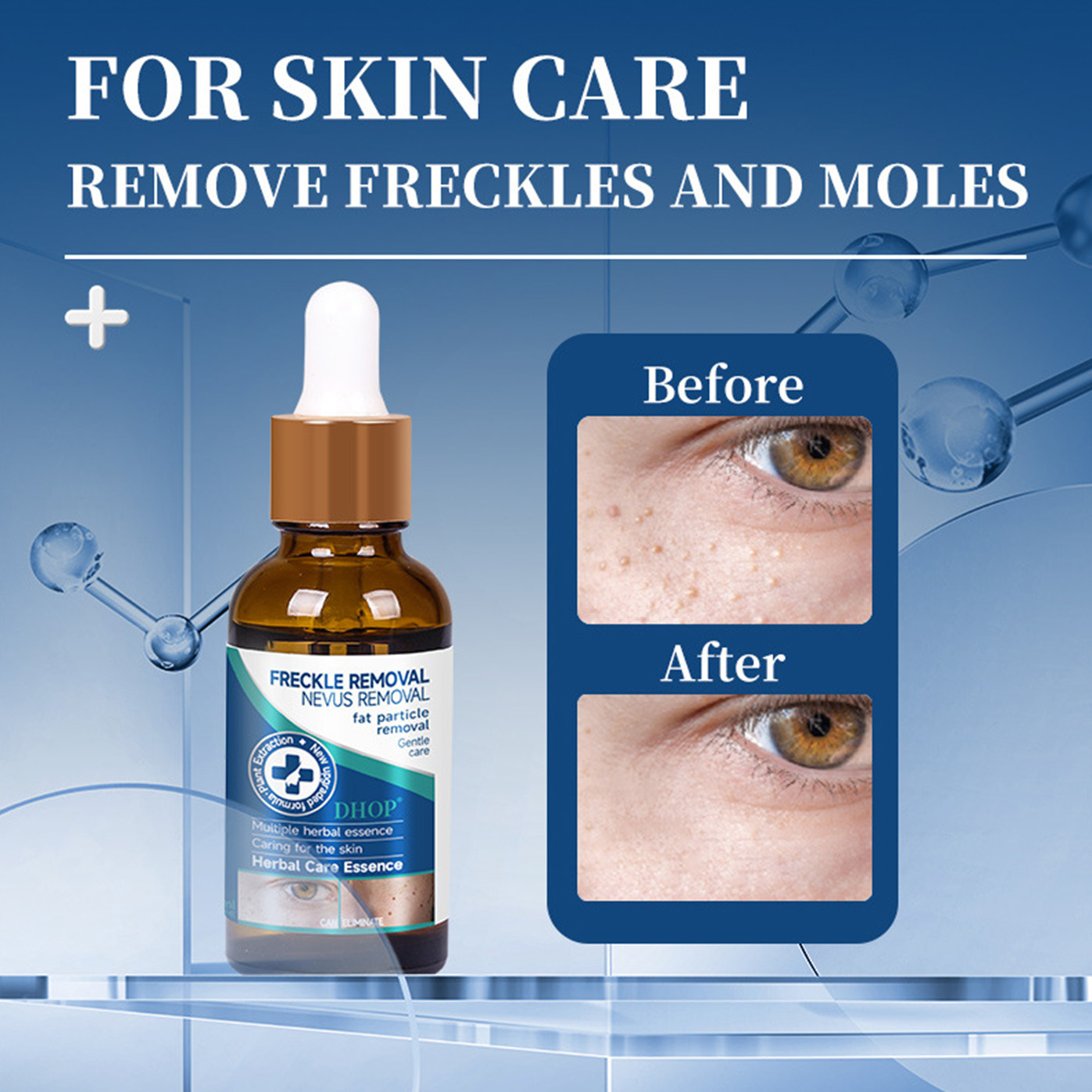 Freckle Removal & Nevus Removal Fat Particle Removal