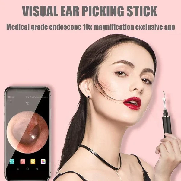 Clearance🔥Clean Earwax-Wi-Fi Visible Wax Removal Spoon, USB 1296P HD Load Otoscope