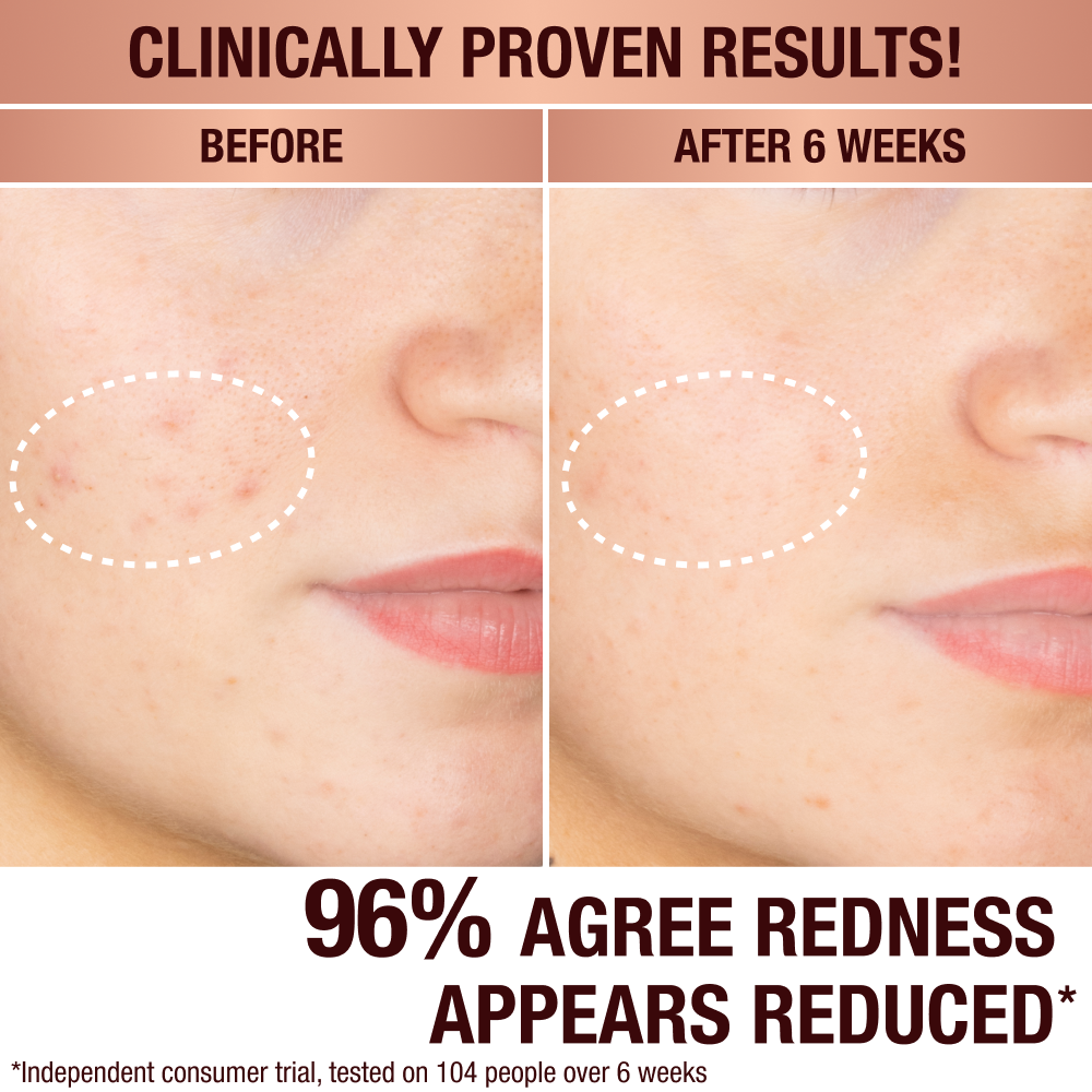 DARK SPOT SERUM & CHARLOTTE’S MAGIC CREAM DUO