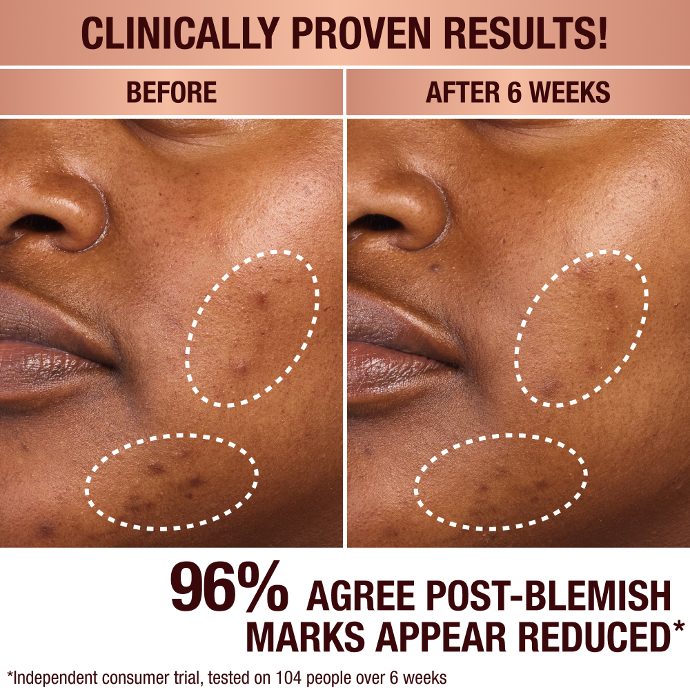 DARK SPOT SERUM & CHARLOTTE’S MAGIC CREAM DUO