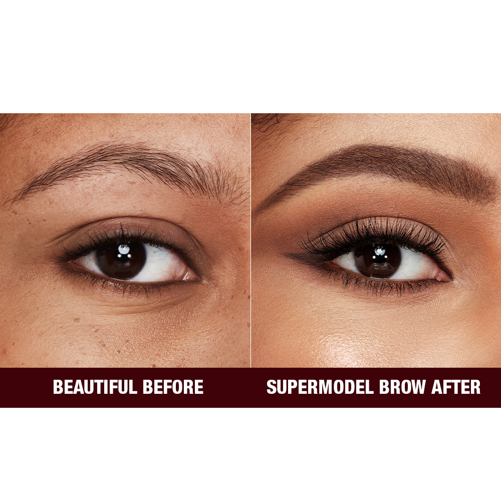 BROW LIFT